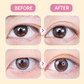 Invisible Strong Support Double Eyelid Tapes for Enlarging Eyes