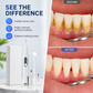 📢📢40% OFF !! ⏰Portable Ultrasonic Teeth Cleaner and Tartar Remover Set